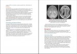 دانلود کتاب ژنتیک پزشکی تامپسون 1233 صفحه PDF 📘-1