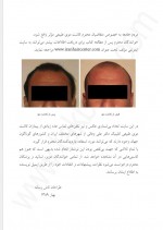 دانلود کتاب کاشت موی طبیعی علی وفائی 186 صفحه PDF 📘-1