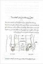 دانلود کتاب سرطان پروستات مرتضی مدنی نژاد 33 صفحه PDF 📘-1