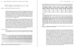 دانلود کتاب Cardiac Arrhythmias Second Edition اریک پریستوفسکی 530 صفحه PDF 📘-1