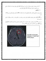 دانلود کتاب فیزیوتراپی در MS علیرضا پاک قلب 19 صفحه PDF 📘-1